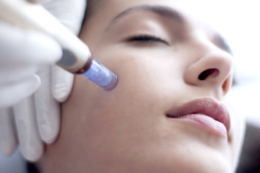 Le MICRO-NEEDLING : Un soin revitalisant complet pour votre peau