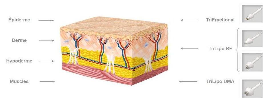 TriLipo™ MED - La procédure anti-âge la plus complète - Dr Azoulay