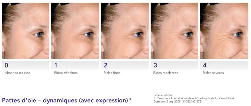Le vieillissement du visage - Dr Azoulay, médecine esthétique à Boulogne