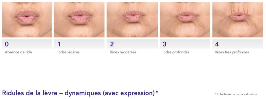 Le vieillissement du visage - Dr Azoulay, médecine esthétique à Boulogne