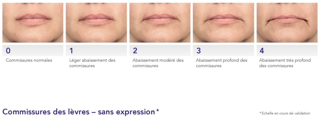 Le vieillissement du visage - Dr Azoulay, médecine esthétique à Boulogne