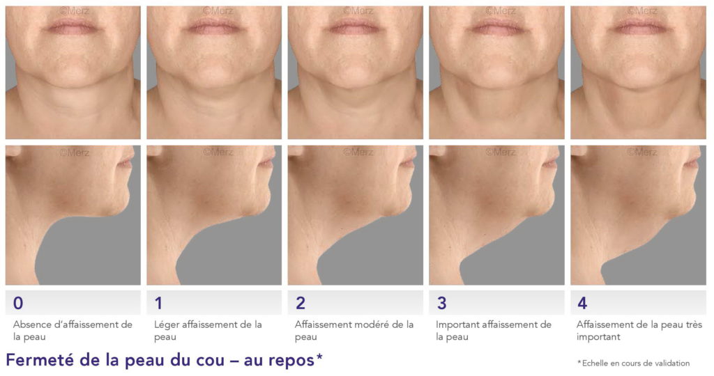 Le vieillissement du visage - Dr Azoulay, médecine esthétique à Boulogne