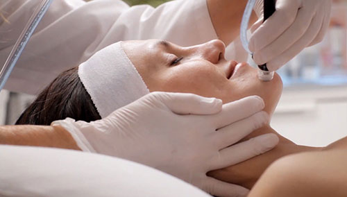 Microdermabrasion VS Microneedling