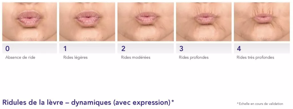 Le vieillissement du visage - Dr Azoulay, médecine esthétique à Boulogne