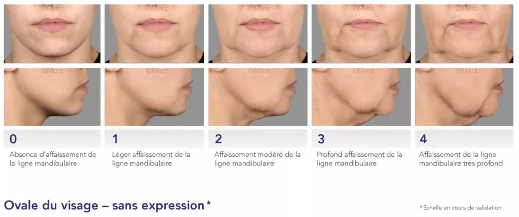 Le vieillissement du visage - Dr Azoulay, médecine esthétique à Boulogne