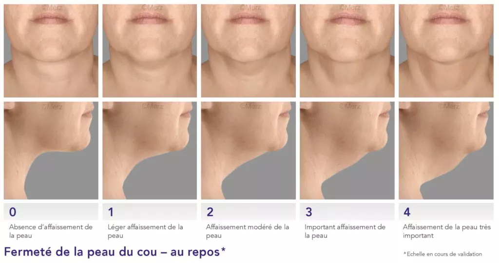 Le vieillissement du visage - Dr Azoulay, médecine esthétique à Boulogne