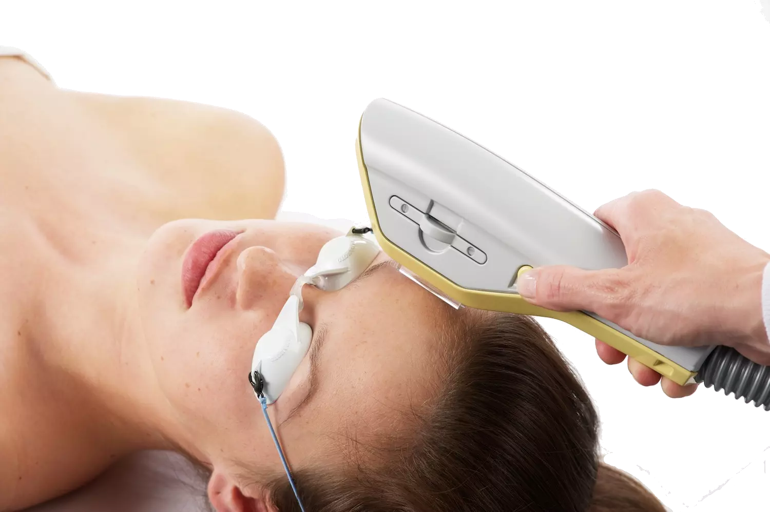 EXILITE® : Nouvelle génération de traitement IPL